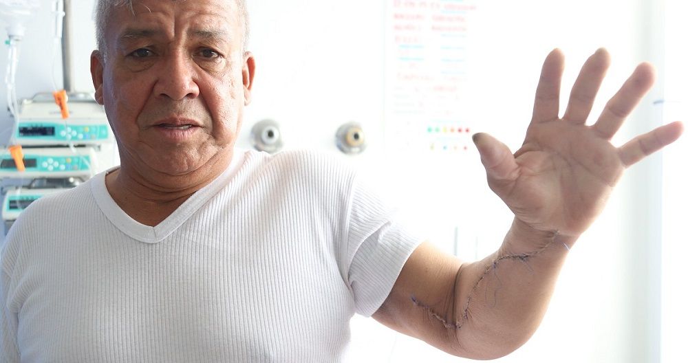 Discapacidad en el brazo - Formula Medica Discapacidad en el brazo - Formula Medica