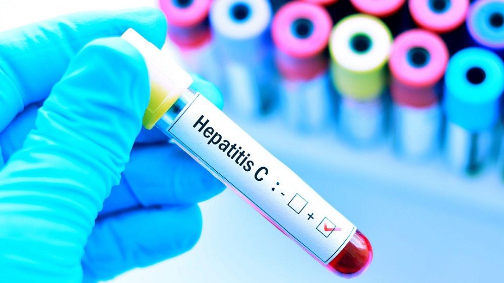 1.413 personas tienen diagnóstico de hepatitis C crónica en el régimen contributivo Hepatitis C - Formula Medica