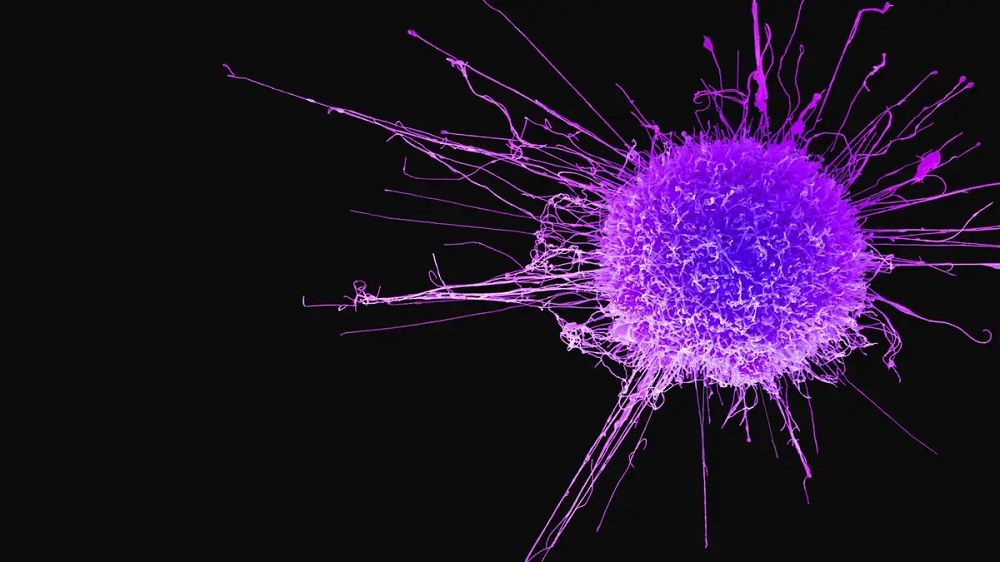 Tratamiento contra el cancer - Formula Medica Tratamiento contra el cancer - Formula Medica