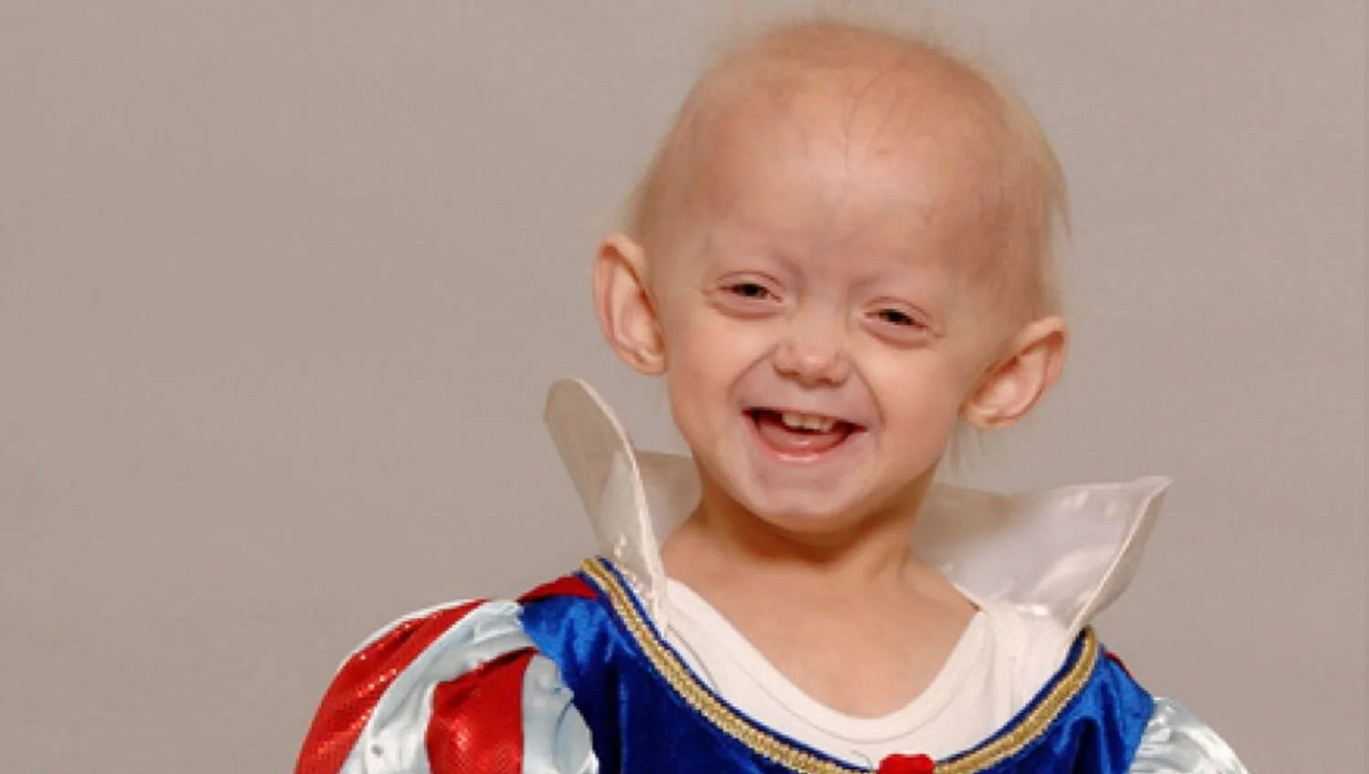 Emotiva historia de David Pérez, niño de 10 años con una enfermedad huérfana de la que se tienen más dudas que certezas