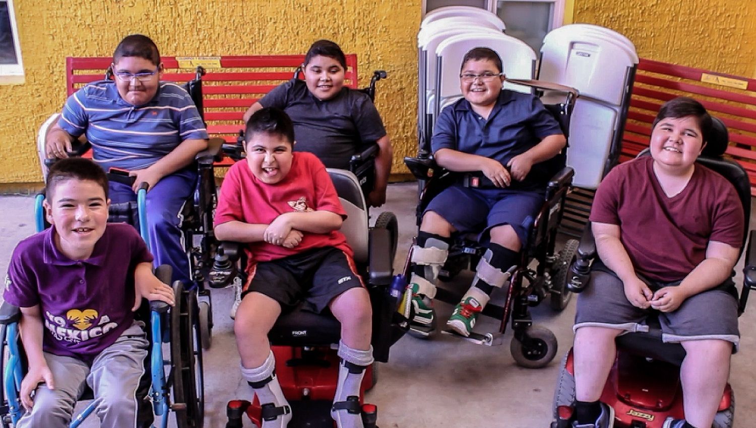 Urge un diagnóstico oportuno en la Distrofia Muscular de Duchenne Distrofia Muscular Duchenne - Formula Medica