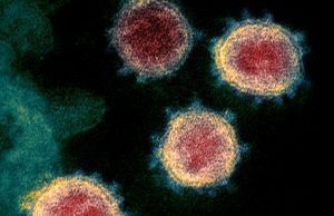 Investigadores del INS descifran la primera secuencia genética de SARS-CoV-2 en Colombia Investigadores del INS descifran la primera secuencia genética de SARS-CoV-2 - Fórmula Médica