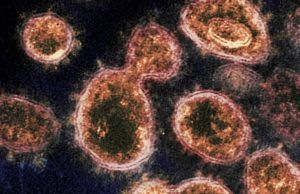 Ya son 4.561 casos confirmados en Colombia con COVID-19 4.561 casos confirmados en Colombia con COVID-19 - Fórmula Médica
