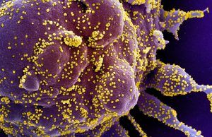 La cifra de contagios con COVID-19 ascendió a 73.572 73.572 personas en Colombia tienen COVID-19 - Fórmula Médica