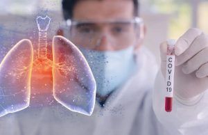 Colombia superó los 150.000 casos positivos con COVID-19 150.445 personas en Colombia tienen COVID-19 - Fórmula Médica