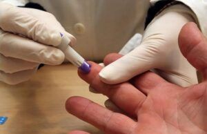 Pruebas rápidas para detectar enfermedades como el VIH, Sífilis o Hepatitis Pruebas rápidas para detectar el VIH Sífilis o Hepatitis - Fórmula Médica