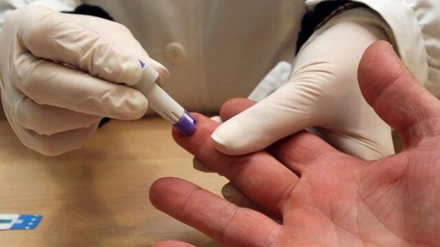 Pruebas rápidas para detectar el VIH Sífilis o Hepatitis - Fórmula Médica Pruebas rápidas para detectar el VIH Sífilis o Hepatitis - Fórmula Médica