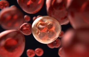 Leucemia Mieloide Crónica: un diagnóstico oportuno puede salvar vidas Leucemia Mieloide Crónica - Fórmula Médica