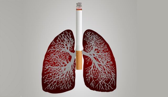 Cáncer de pulmón - Fórmula Médica Cáncer de pulmón - Fórmula Médica