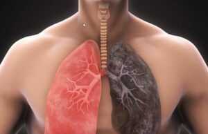 El primer riesgo para tener una enfermedad pulmonar es tener pulmones Enfermedad pulmonar - Fórmula Médica
