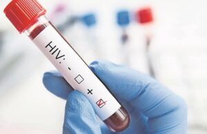 Los casos de infección por VIH aumentaron un 21% en América Latina en la última década VIH - Fórmula Médica
