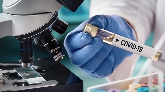 Pruebas PCR - Fórmula Médica Pruebas PCR - Fórmula Médica