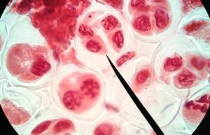 Células madre: El poder para mejorar la calidad de vida Células madre - Fórmula Médica