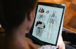Al día con la enfermedad de Gaucher Enfermedad de Gaucher - Fórmula Médica
