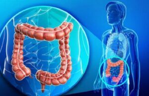 Colombia da paso a tratamiento contra cáncer colorrectal avanzado que aumenta las esperanzas de vida Cáncer de colon - Fórmula Médica
