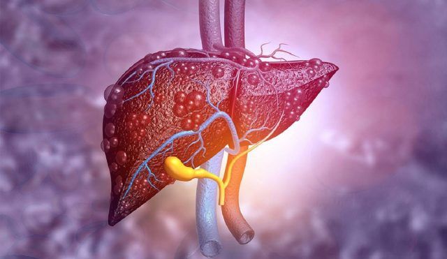 Hepatitis - Fórmula Médica Hepatitis - Fórmula Médica