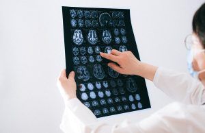 4 tips para mantener sano tu cerebro Cerebro - Fórmula Médica