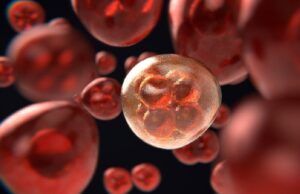 Leucemia, cada minuto importa tras un diagnóstico de cáncer de sangre Leucemia - Fórmula Médica