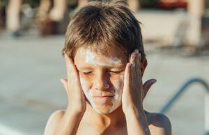Tenga cuidado con estos signos de alarma si se presenta una quemadura solar Quemadura solar - Fórmula Médica