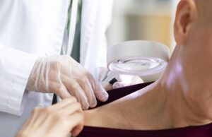 Cáncer de piel, uno de los más comunes en el mundo; ¿qué hacer y cómo evitarlo? Cáncer de piel - Fórmula Médica