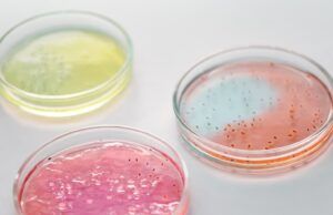 Dos de cada cinco muertes por infecciones en Latinoamérica se relacionan con la resistencia antimicrobiana Resistencia antimicrobiana - Fórmula Médica