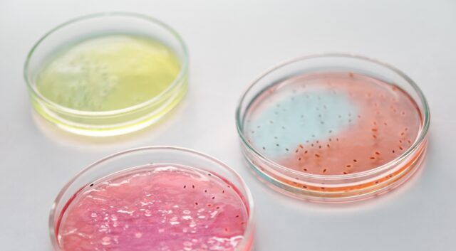 Resistencia antimicrobiana - Fórmula Médica Resistencia antimicrobiana - Fórmula Médica