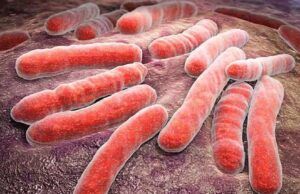 Minsalud garantiza tratamientos para pacientes con tuberculosis farmacorresistente Tuberculosis - Fórmula Médica