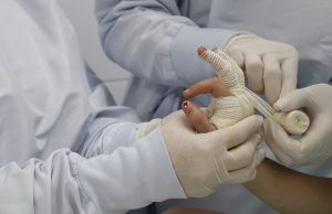 Quemaduras con líquidos son las más frecuentes durante la temporada de fin de año en Antioquia Quemaduras con líquidos - Fórmula Médica