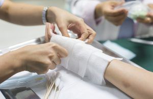 El 91.8% de personas con quemaduras en época decembrinas son por pólvora Personas con quemaduras - Fórmula Médica