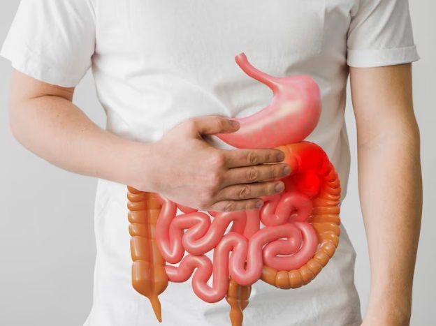 Enfermedad de Crohn - Fórmula Médica
