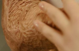Cómo evitar riesgos y actuar ante quemaduras con pólvora Quemaduras con pólvora - Fórmula Médica