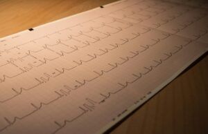 ¿Cómo prevenir la muerte súbita y otras complicaciones derivadas de la Miocardiopatía Hipertrófica Obstructiva? Miocardiopatía Hipertrófica Obstructiva - Fórmula Médica