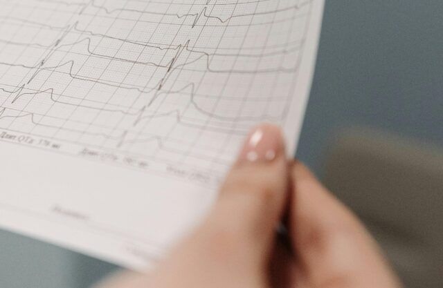 Arritmia cardíaca - Fórmula Médica Arritmia cardíaca - Fórmula Médica